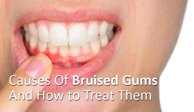 sore gums after dentist visit